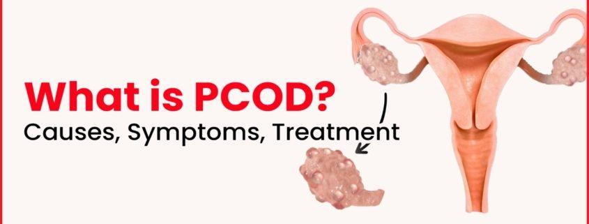 PCOD Treatment