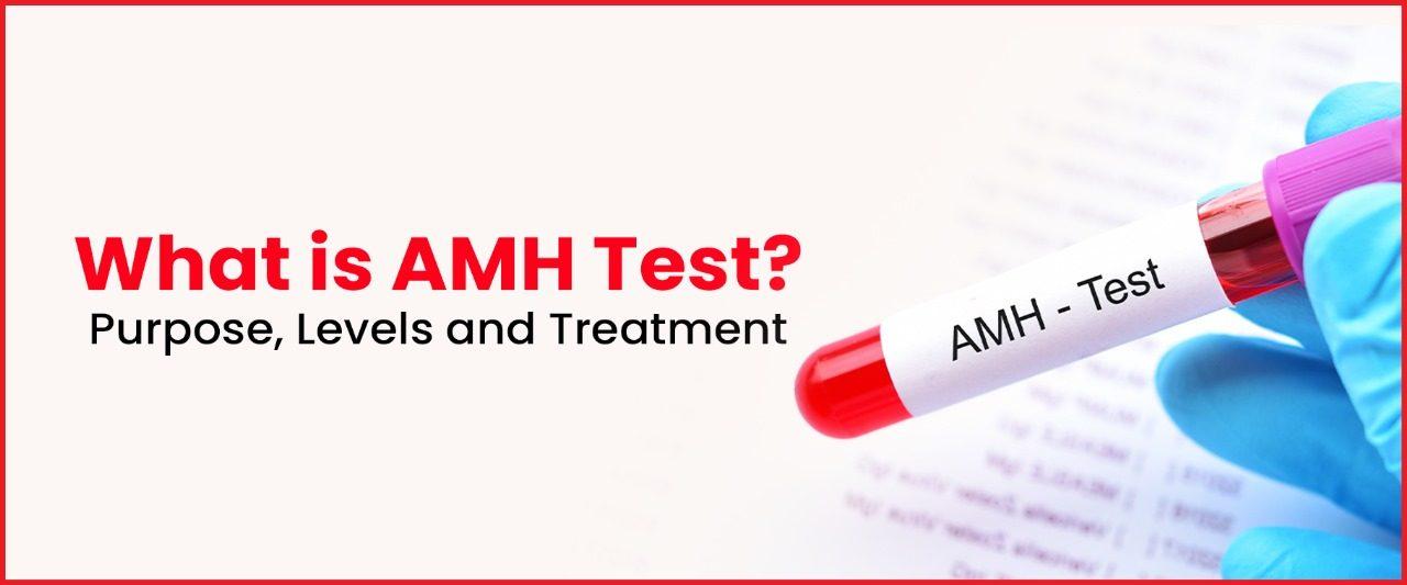 What is AMH Test