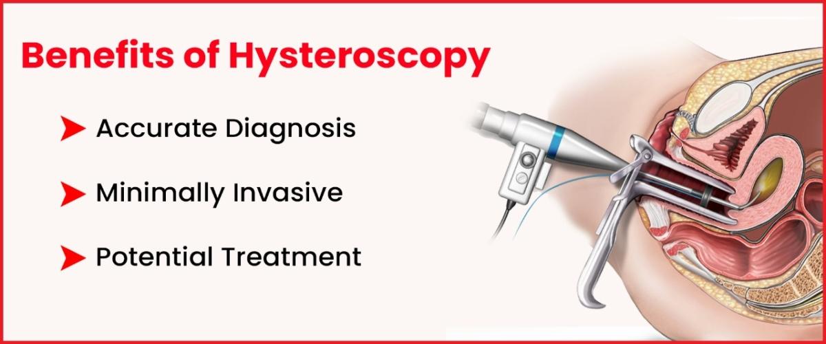 Benefits of Hysteroscopy