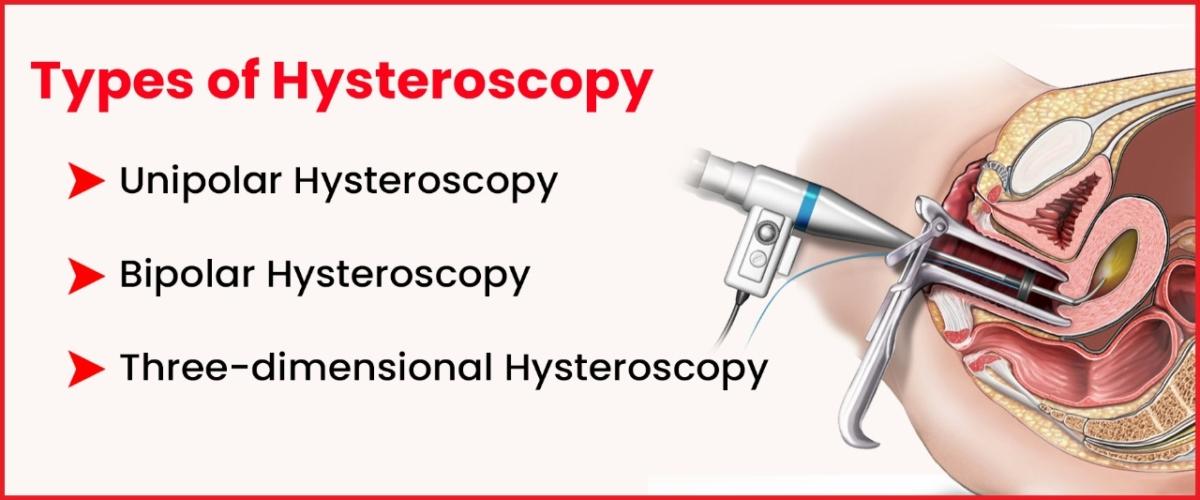 Types of Hysteroscopy