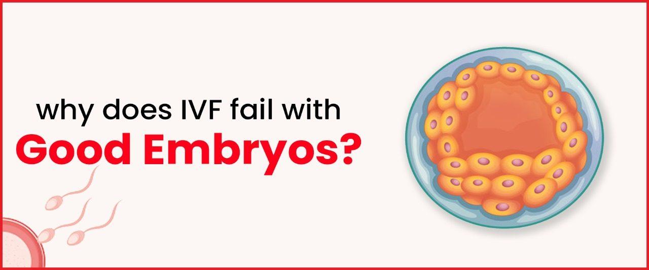 Why IVF Fail with Good Embryos