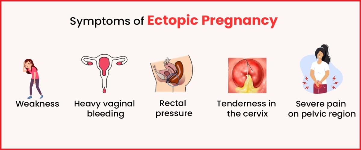 Symptoms of Ectopic Pregnancy