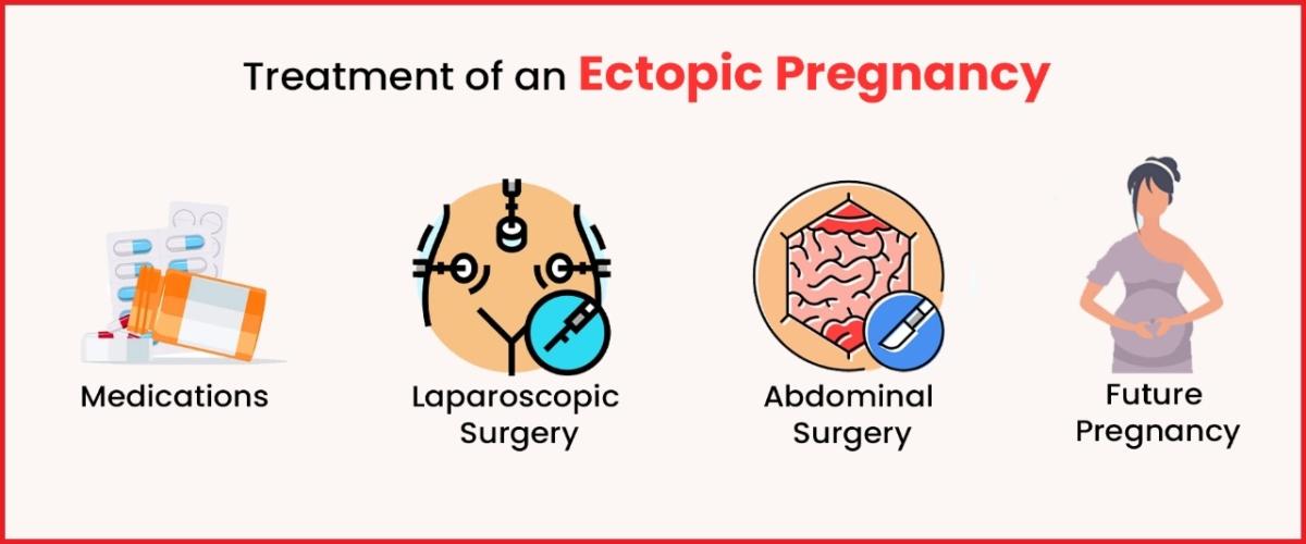 Treatment of Ectopic Pregnancy
