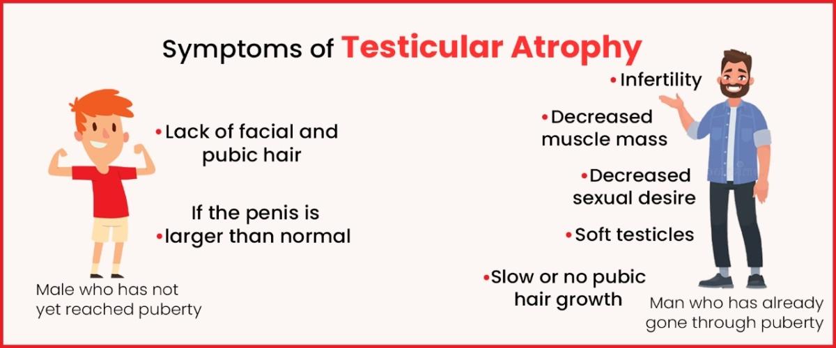 Symptoms of Testicular Atrophy